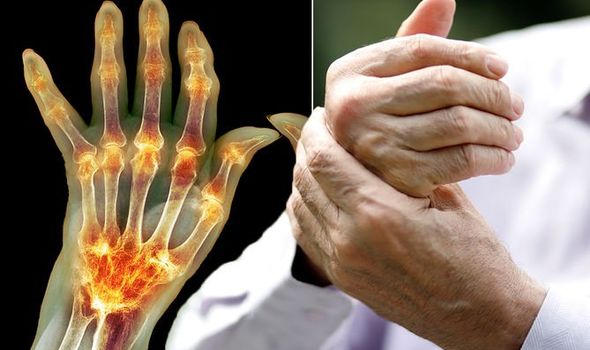 Living with Arthritis